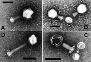 Electron micrograph images of cyanophages. Image via Wikimedia Commons
