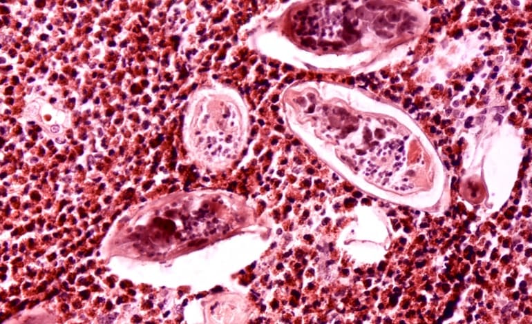 Schistosomiasis inequality