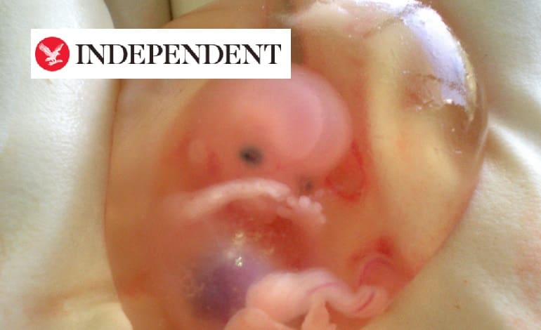 Independent Abortion Iceland