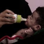 A baby in Yemen being fed with a bottle