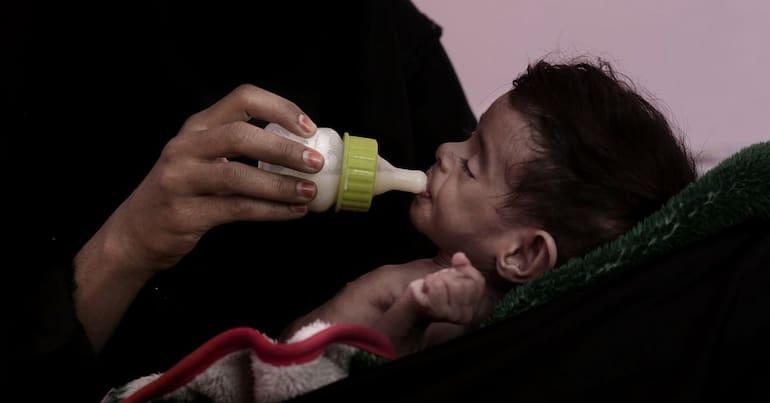 A baby in Yemen being fed with a bottle