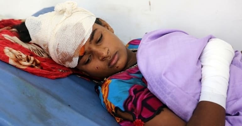 A Yemeni child who was injured in air strike in the district of Al-Hali in Hodeida province, receive treatment at a hospital on April 2, 2018.