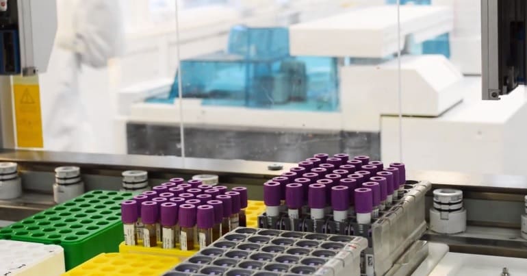 blood samples in a laboratory