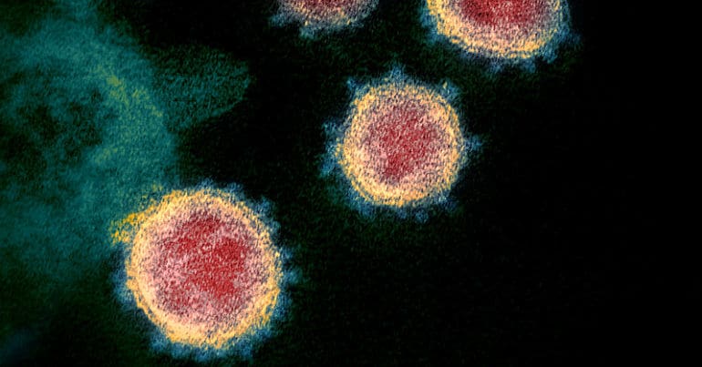 Coronavirus