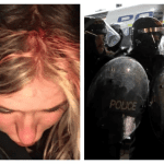 A picture of riot police, and of Fleur Moody's head injury