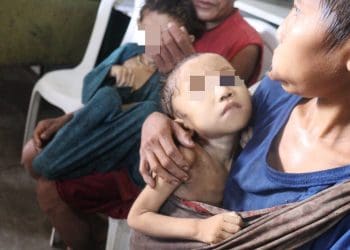 A sick Yanomami child Brazil