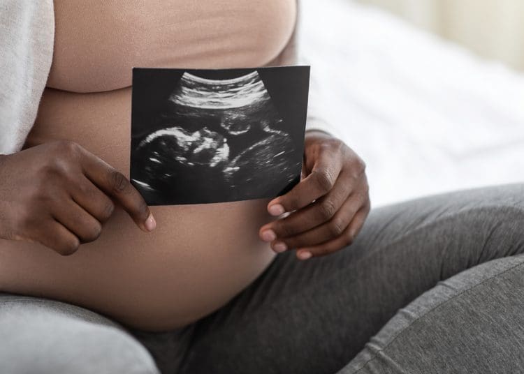MBRRACE-UK a pregnant woman holding a scan