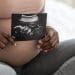 MBRRACE-UK a pregnant woman holding a scan