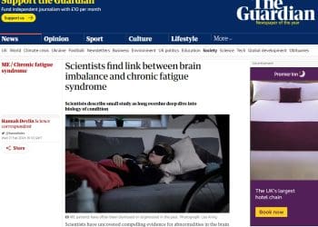 ME long Covid Guardian report on NIH study plus REGAIN