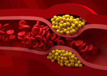 cholesterol