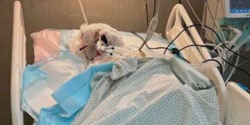 The media blackout on Israel burning Palestinian journalist Ahmad Mansour alive is now to be expected