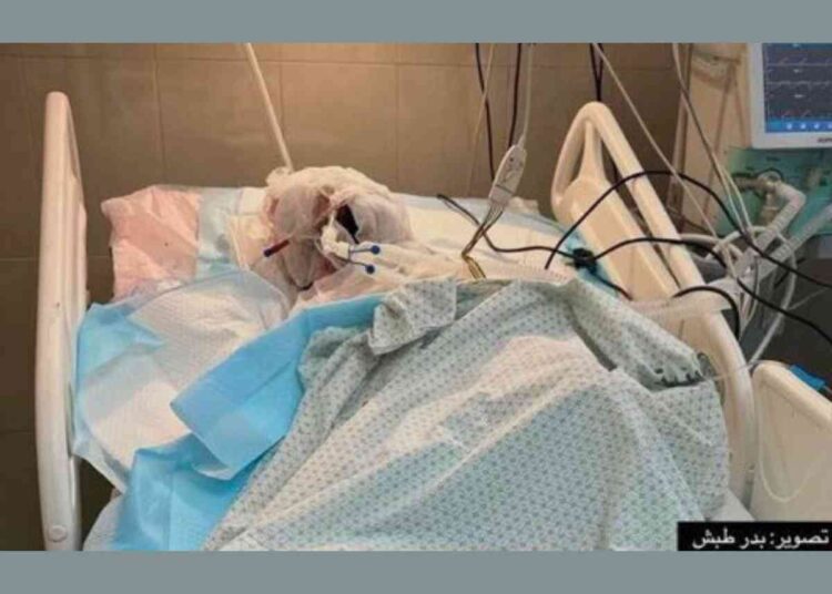 The media blackout on Israel burning Palestinian journalist Ahmad Mansour alive is now to be expected