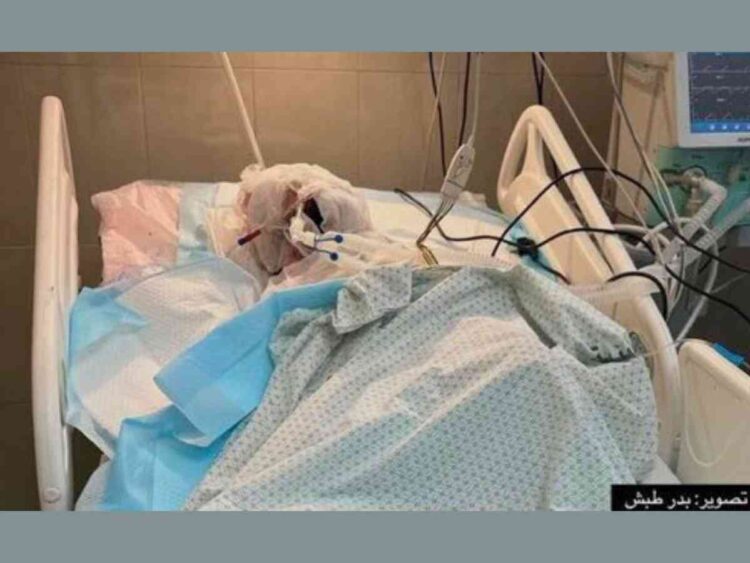 The media blackout on Israel burning Palestinian journalist Ahmad Mansour alive is now to be expected