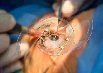 Botched cataract surgery while firms make millions shows why NHS privatisation is a disaster