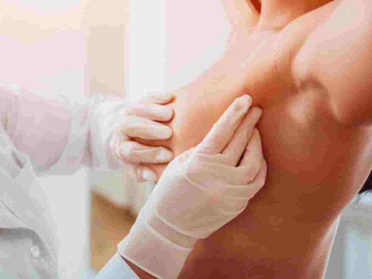 Women's cancers get 20% less funding than male cancers, despite much worse survival rates