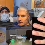 Montage of Jason. Top left: Jason in face mask and with eye mask looking up from bed. Top centre: Jason on his most recent birthday, in hospital with a mask on his head like a party hat. Top right: cannula on Jason's hand. Bottom left: gross-looking mash potato and cauliflower in a bowl. Bottom centre: Multiple water jugs on a table with a cup. Bottom right: Jason's hand swelled up severe ME