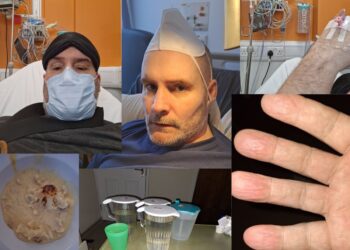 Montage of Jason. Top left: Jason in face mask and with eye mask looking up from bed. Top centre: Jason on his most recent birthday, in hospital with a mask on his head like a party hat. Top right: cannula on Jason's hand. Bottom left: gross-looking mash potato and cauliflower in a bowl. Bottom centre: Multiple water jugs on a table with a cup. Bottom right: Jason's hand swelled up severe ME