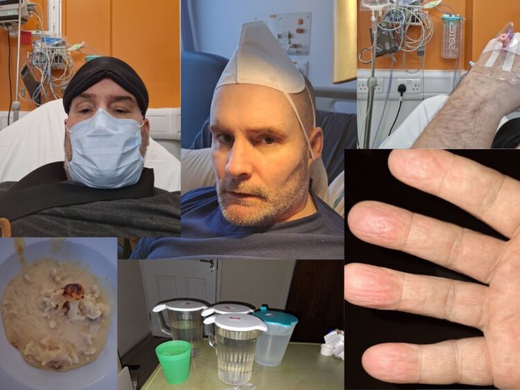 Montage of Jason. Top left: Jason in face mask and with eye mask looking up from bed. Top centre: Jason on his most recent birthday, in hospital with a mask on his head like a party hat. Top right: cannula on Jason's hand. Bottom left: gross-looking mash potato and cauliflower in a bowl. Bottom centre: Multiple water jugs on a table with a cup. Bottom right: Jason's hand swelled up severe ME