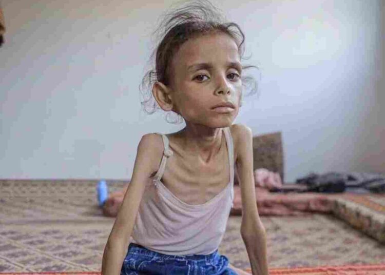 Israel famine