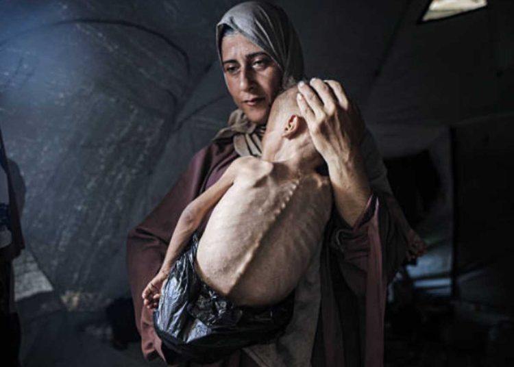 Amnesty International accuse Israel of manufactured starvation