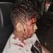 Israeli attack