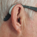 HIV earwax