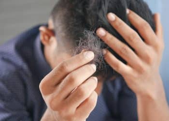 From Self-Conscious to Self-Assured: How a Thoughtful Hair Transplant Restores Everyday Confidence