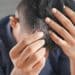 From Self-Conscious to Self-Assured: How a Thoughtful Hair Transplant Restores Everyday Confidence