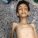 Humanitarian aid