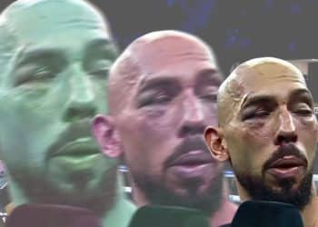 Images of Andrew Tate with his face banged up