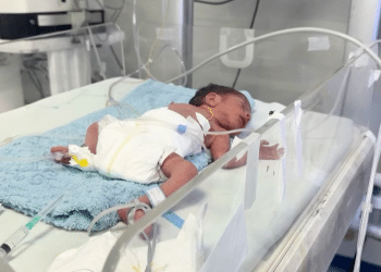 Premature births on the rise in Gaza