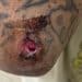 A bloody wound on a tattooed limb following an attack by Israeli settlers in Ramallah