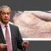 Nigel Farage and a person suffering from measles