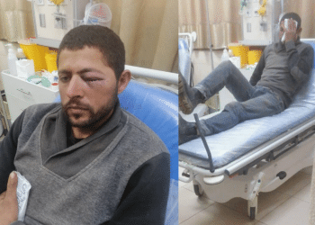 Two photos side by side: a Palestinian man in hospital whose left eye is swollen shit and another photo of him in bed holding what appears to be an ice pack over his eye