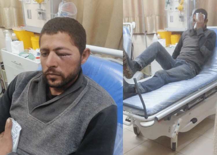 Two photos side by side: a Palestinian man in hospital whose left eye is swollen shit and another photo of him in bed holding what appears to be an ice pack over his eye