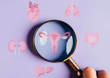PCOS