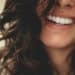 Smile Design Before and After: What Changes Can You Expect?