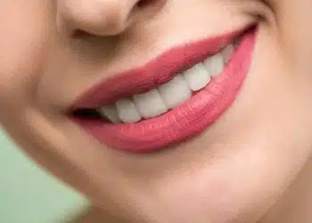Smile Makeover vs Veneers: Understanding the Differences and Choosing the Right Option